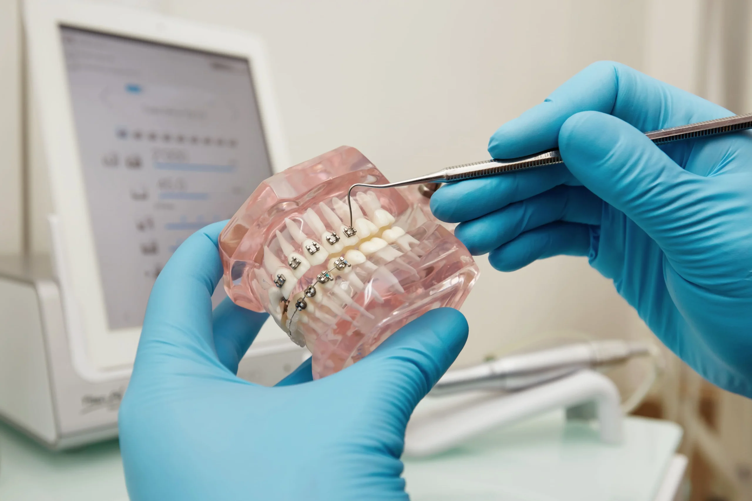 Ortodoncia Invisible O Brackets En Palma De Mallorca clinica dental llibertat